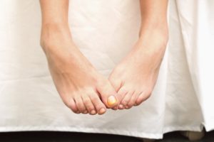 The Best Home Remedies For Treating Onychomycosis